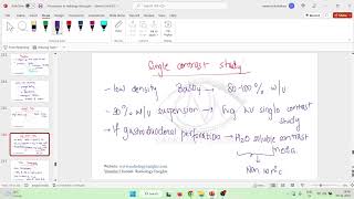 Lec 2 Barium Meal Preparation and Types of Contrast mkv [upl. by Sharleen]