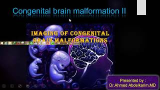 2Congenital brain malformation [upl. by Doble]