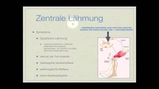 Basiskurs Neurologie Lähmungen Teil 214 [upl. by June454]