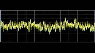 Alopecia Hair Loss  Rife Frequencies [upl. by Ellatsyrc]