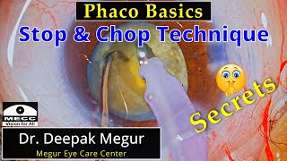 Phaco Basics  Stop amp Chop technique Re visited  Dr Deepak Megur [upl. by Forta832]