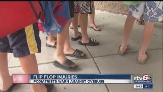 Experts warn against wearing flipflops every day [upl. by Suidaht]