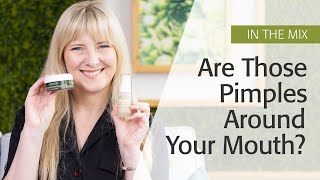 What To Do About The Appearance Of Acne Around The Mouth  Eminence Organics [upl. by Nahsin482]