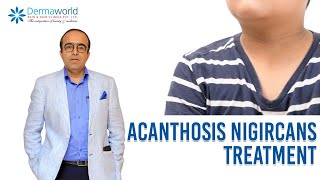 Acanthosis Nigircans Treatment  In Hindi  Dr Rohit Batra [upl. by Anana]