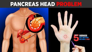 SUJOK TREATMENT FOR Pancreas Head Problem😖🔥ON LEFT HAND [upl. by Song]