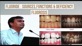 Fluoride  Sources functions deficiency and toxicity  Fluorosis  Biochemistry [upl. by Linnet]