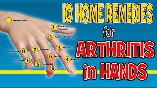 10 Home Remedies for Arthritis in Hands  Pain Relief Diet [upl. by Asnerek]