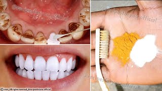 Secret that Dentists dont want you to know Remove Tartar and Teeth Whitening in just 2 minutes [upl. by Aser]