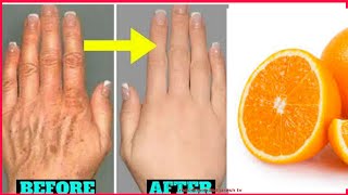 Cucumber anti wrinkle home remedies remove wrinkles from Hands in 5 days  hand wrinkles home remedy [upl. by Ciro]