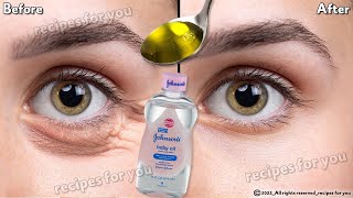 In 3 days Remove Under Eye Bags Completely  Remove Dark Circles Wrinkles and Puffy Eyes [upl. by Rafael]