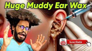 Huge Muddy Ear Wax earwaxremoval earwax [upl. by Ruffo878]