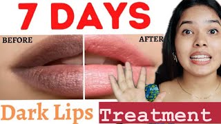 How to get Pink lips in 7 Days  7 Days Dark Lips removal  Pigmented Lips Treatment [upl. by Sanchez152]