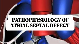 PATHOPHYSIOLOGY OF ATRIAL SEPTAL DEFECT [upl. by Hamfurd]