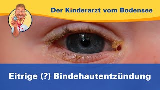 Eitrige  Bindehautentzündung — Der Kinderarzt vom Bodensee [upl. by Levon41]