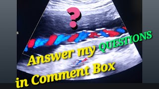 Today You Tell Me Baby Ultrasound Genderreveal  Cephalic or Breech  Placenta Anterior or Posterior [upl. by Braynard451]