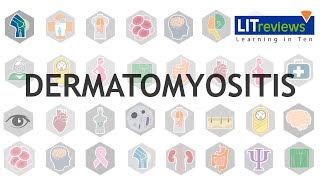 Dermatomyositis [upl. by Nostaw]