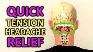 Tension Headache Exercises Stress Headache Relief in 4 Minutes [upl. by Yssirc51]