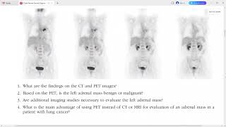 GENITOURINARY RADIOLOGY CASE REVIEW SERIES [upl. by Ivar]