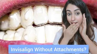 Can I Have Invisalign Without Attachments [upl. by Kjersti]