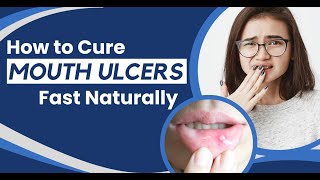 Mouth Ulcers How to Get Rid of Mouth Ulcers Overnight  The Health Site [upl. by Anelej]