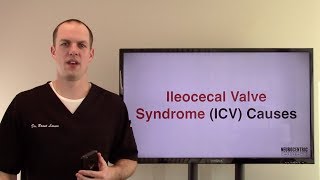 Ileocecal Valve Syndrome Causes [upl. by Annez454]