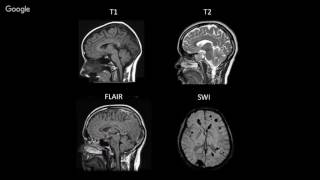 Establishing a Normative Neuroimaging Library to Support TBI Diagnosis amp Management [upl. by Virgilia450]