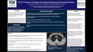 Not So Common Cold RhinovirusInduced Spontaneous Pneumomediastinum [upl. by Yelrahs]