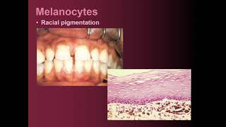 Oral mucosa  Nonkeratinocytes lamina propria amp Basal lamina [upl. by Namad]