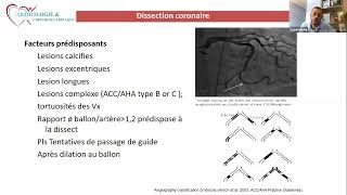 CSCWebinar 017 Gestion des complications du cathétérisme cardiaque interventionnel [upl. by Notyep]