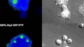 Smart proteins make macrophages better cancereating machines [upl. by Etnuhs295]