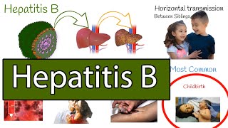 Hepatitis B symptoms treatment and prevention [upl. by Verada]