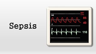 Sepsis and Septic Shock Treatment in Emergency Sepsis Treatment Guidelines Symptoms amp Management [upl. by Eadrahc]