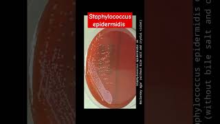 Staphylococcus epidermidis growth on various culture media wet mount and Gram Staining [upl. by Jennie792]