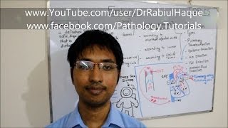 Embolism  Definition Types Pathogenesis Clinical Consequences HD [upl. by Aveneg29]