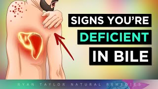 12 Strange Signs of a BILE Deficiency [upl. by Beedon]