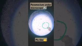 Paramecium under a Microscope🔬 Animal of protozoa 🦭Advance Science🌏🔬 [upl. by Bozuwa]