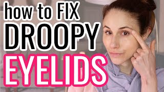 How to FIX DROOPY HOODED EYELIDS Dr Dray [upl. by Reamy]