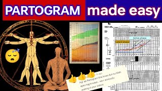 PARTOGRAM ❤️ WHO MODIFIED PARTOGRAM ❤️🙏👍 partogram labour pregnancy mbbs lecture exam [upl. by Odyssey]