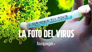 Coronavirus la foto mostra i minimi dettagli ecco come è fatto e perché si chiama così [upl. by Aidaas]