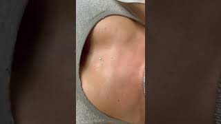 STERNUM MICRODERMAL bodypiercing piercingartist microdermalpiercing piercing piercingstudio [upl. by Alyehc]