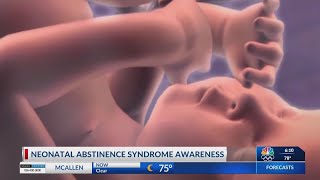 Neonatal Abstinence Syndrome awareness [upl. by Reste]