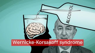 مرض تبون  WernickeKorsakoff syndrome [upl. by Arie]