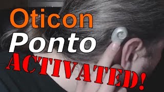 Oticon Ponto plus power  Activation of my bone anchored hearing aid [upl. by Aretta]