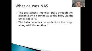 Neonatal Abstinence Syndrome [upl. by Rozina]