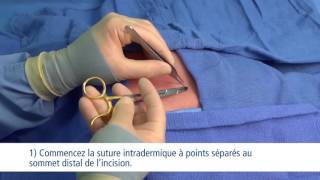 Vidéo de formation sur les techniques de points de sutures [upl. by Fortuna]