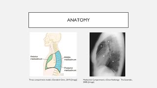 Mediastinal Masses [upl. by Sanferd]