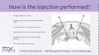 Superior Hypogastric Plexus Block at a Top Tampa Pain Clinic [upl. by Evania]