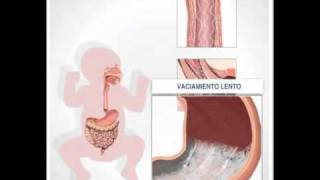 El sistema digestivo del lactante [upl. by Yracaz399]