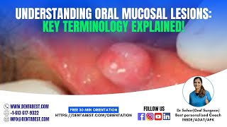 TERMINOLOGYORAL MUCOSAL LESIONS [upl. by Eltsirk259]