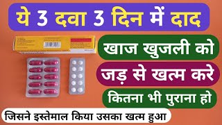 यह 3 दवा 3 दिन में दाद खाज खुजली को जड़ से खत्म करे  3 Best Medicine For Fungal Infection Problem [upl. by Nylehtak]